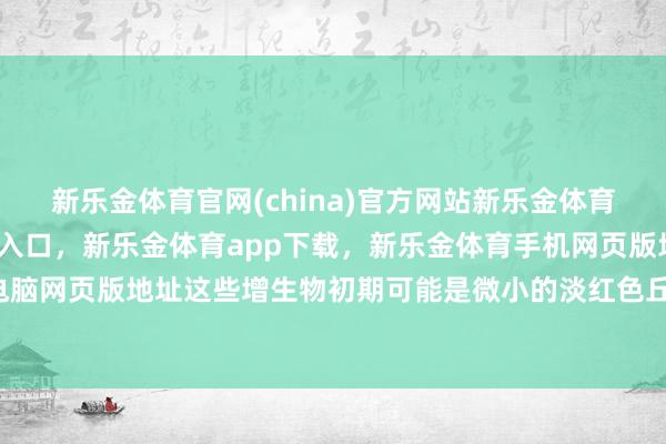 新乐金体育官网(china)官方网站新乐金体育官网中国)官方网站登录入口，新乐金体育app下载，新乐金体育手机网页版地址，新乐金体育电脑网页版地址这些增生物初期可能是微小的淡红色丘疹-(china)官方网站新乐金体育官网中国)官方网站登录入口